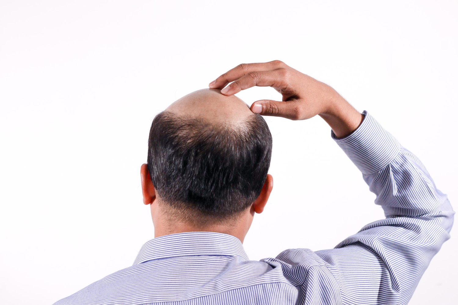 The Science Behind Hair Transplants: How Do They Work 