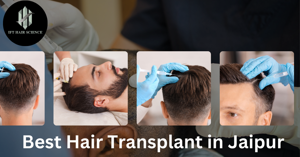 Discover the Best Hair Transplant in Jaipur at IFT Hair Science