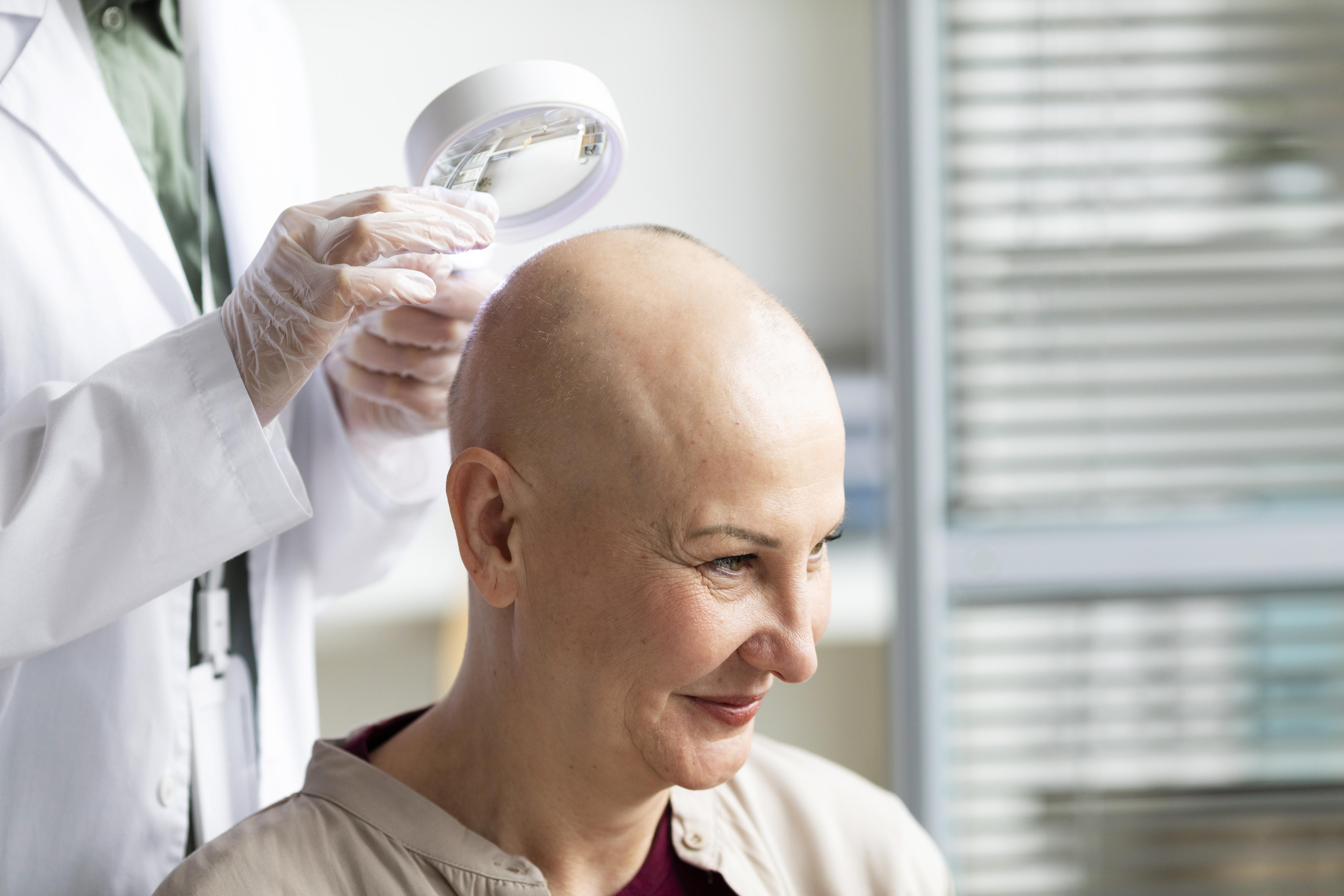 How Effective Are Hair Transplants? Success Rates Explained 