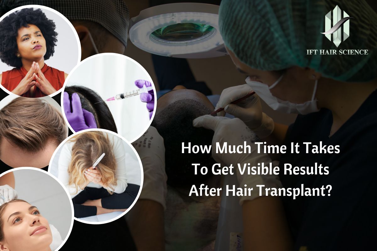  How much time it takes to get visible results after hair transplants