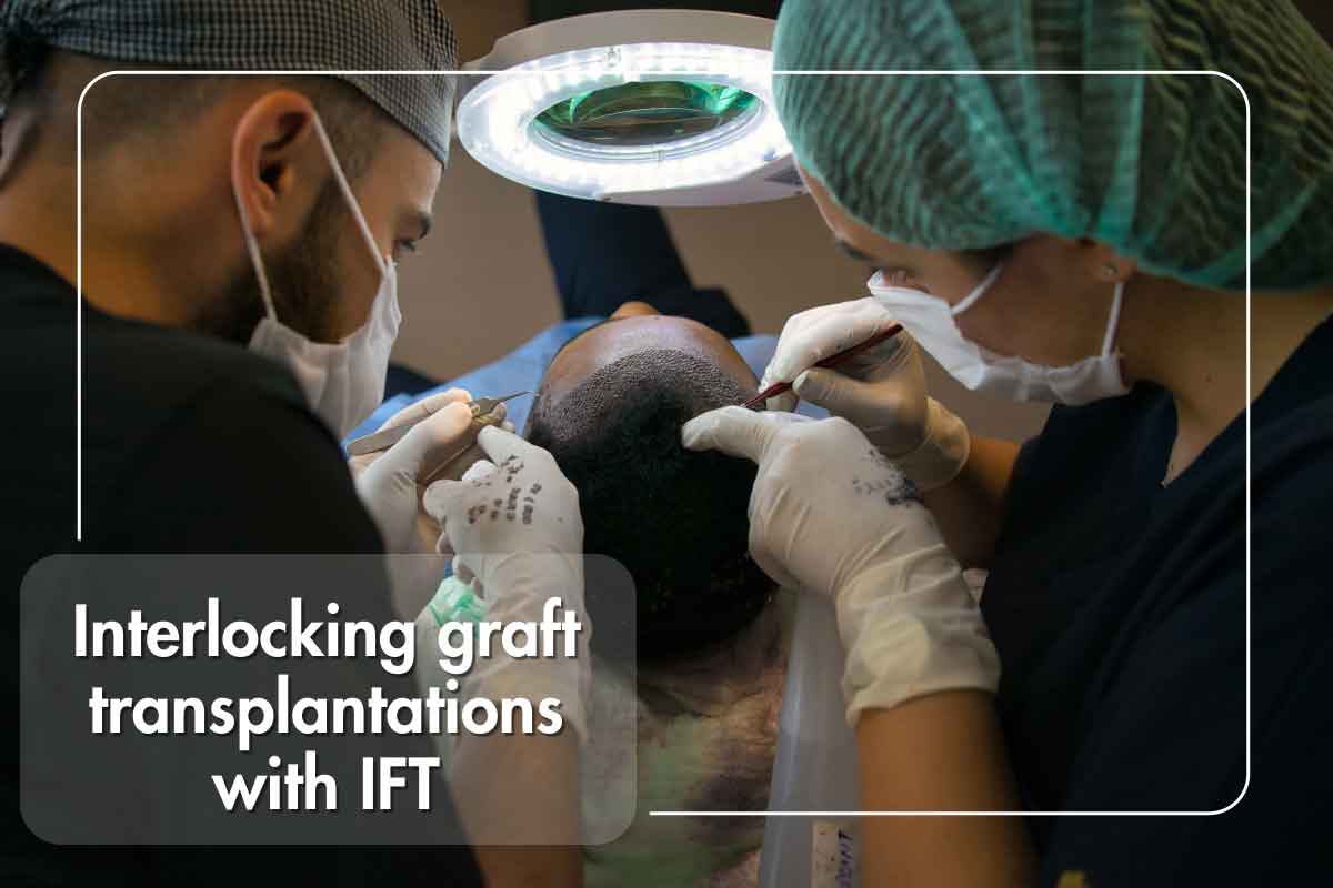 Unlocking the Secrets of Interlocking Graft Transplantation: Innovative Hair Loss Solutions at IFT Hair Science Clinic in Jaipur