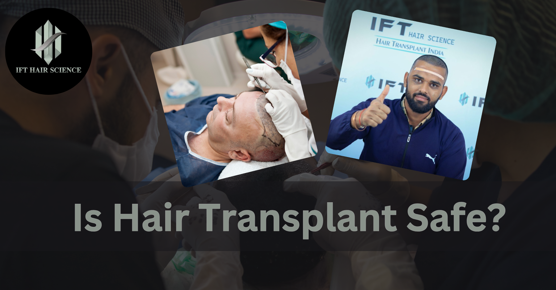 Is Hair Transplant Safe? Understanding the Procedure and Risks