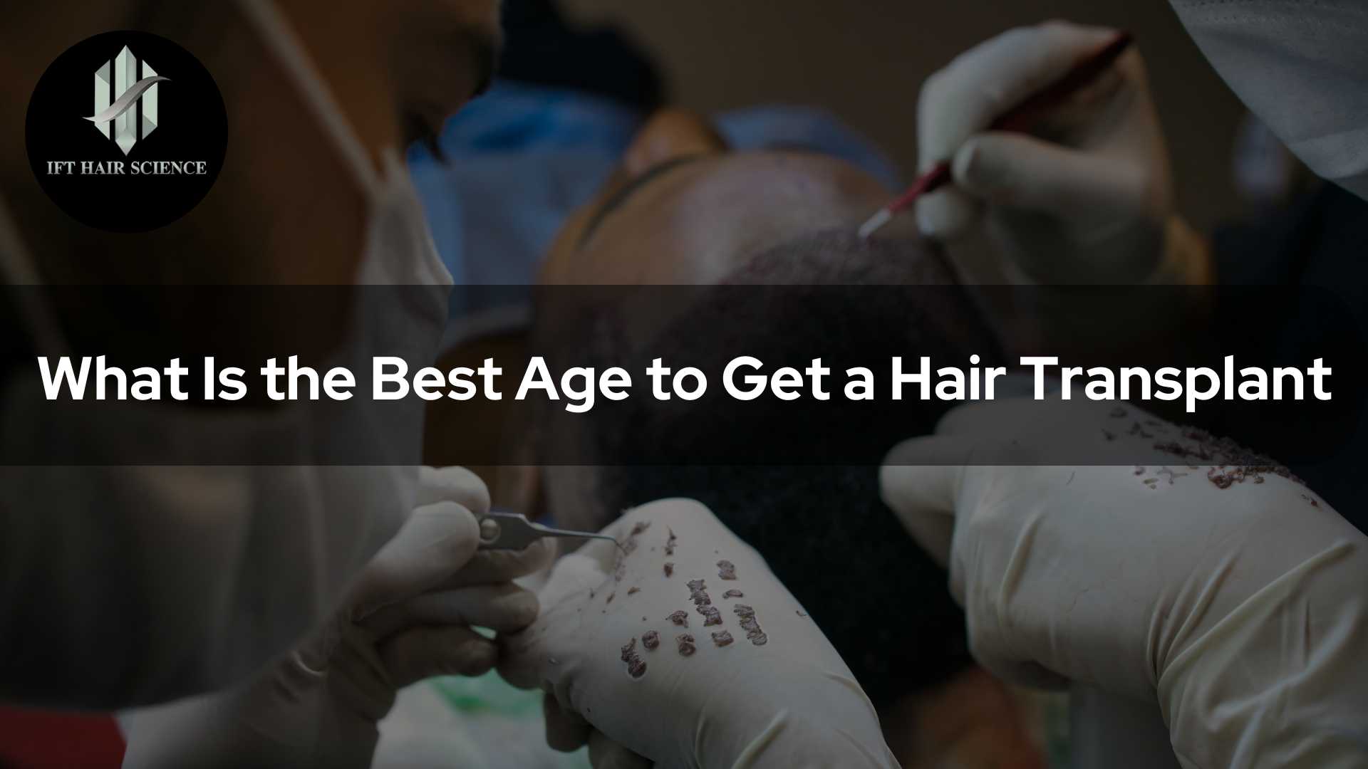 What Is the Best Age to Get a Hair Transplant?