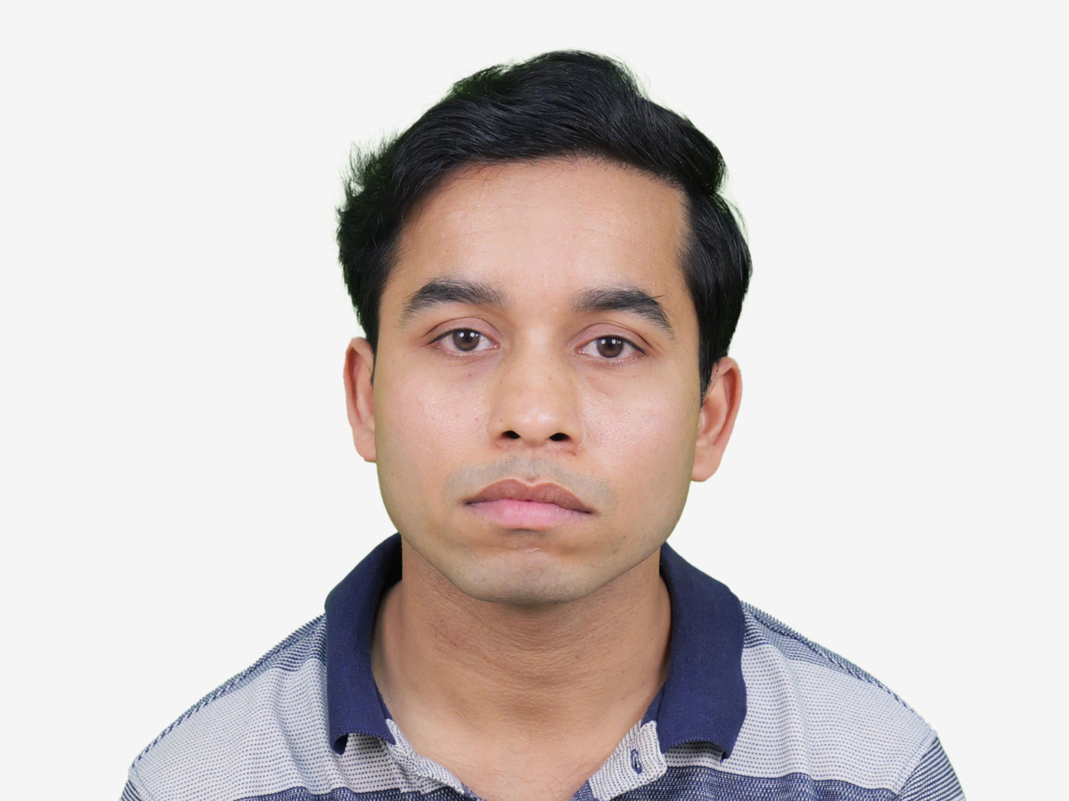 Hair transplant after result