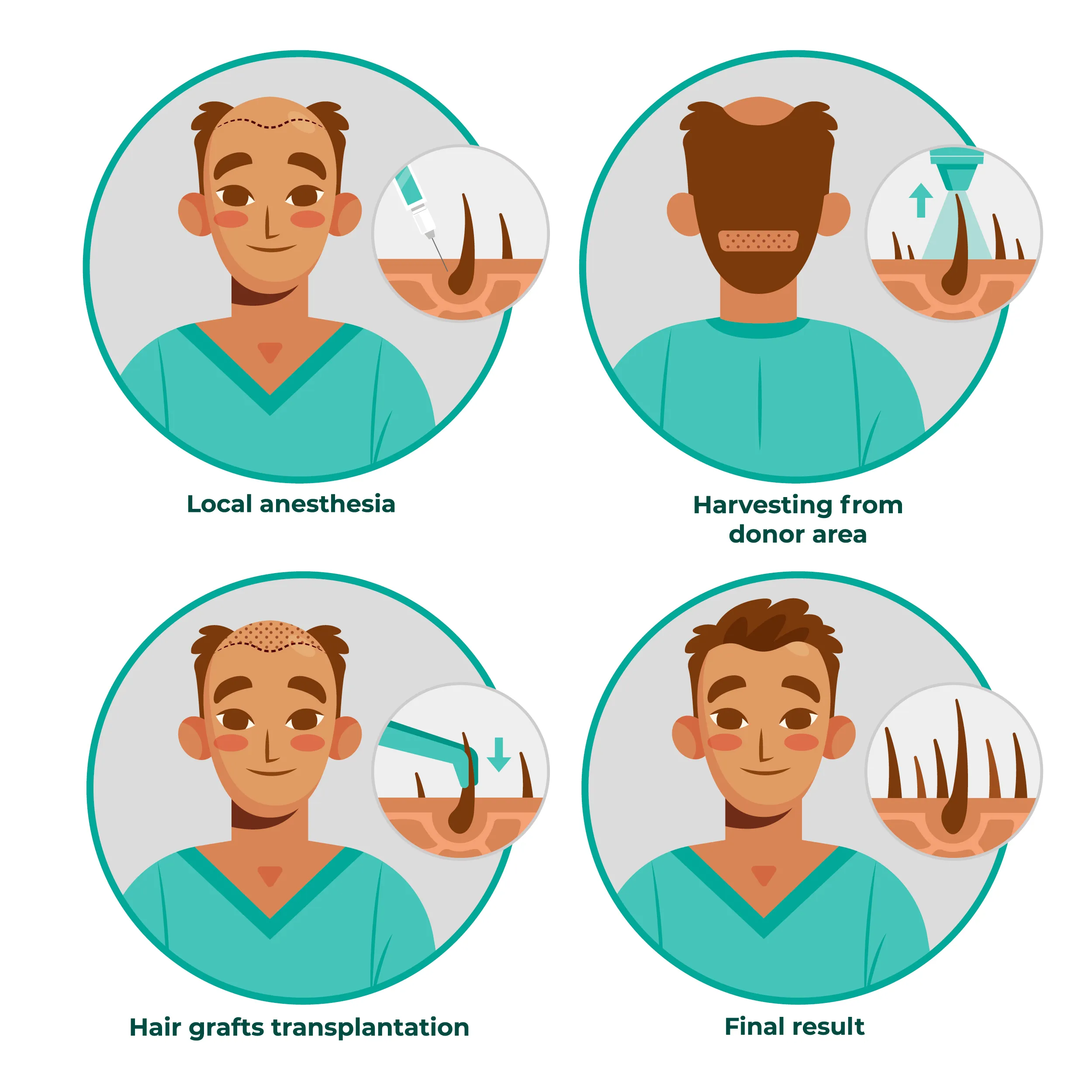 hair transplant in kota