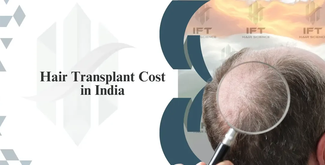 Hair Transplant Cost in India