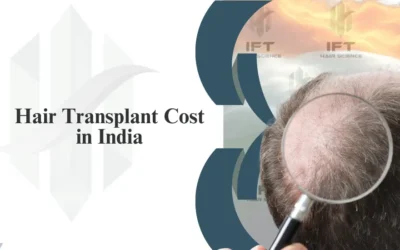How Much Does a Hair Transplant Cost in India?