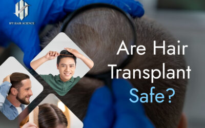 Are hair transplant safe?