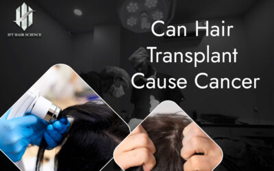 Hair transplant never cause cancer