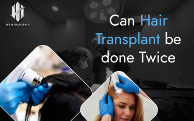 Hair transplant can be done twice