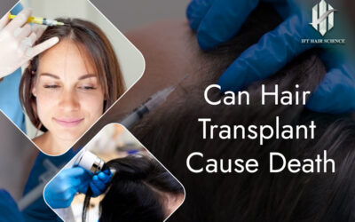 Hair transplant never cause death