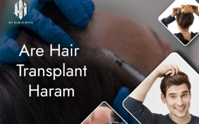 Are hair transplant haram