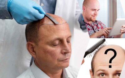 Choosing the Right Clinic for Your Hair Transplant: IFT Hair Science – Best Hair Transplant Clinic In Jaipur