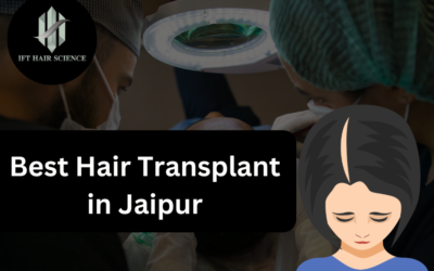Best Hair Transplant in Jaipur: IFT Hair Science