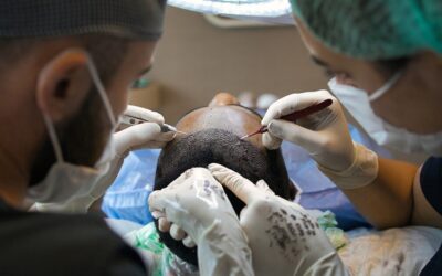 What is the Most Effective Hair Transplant Treatment?