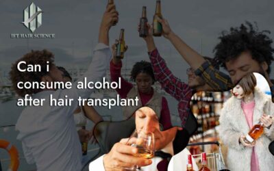 Can I Consume Alcohol After Hair Transplant