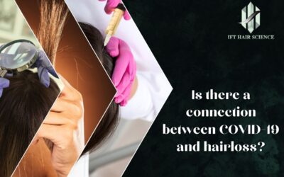 Is There A Connection between COVID-19 and Hair Loss