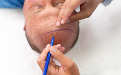How Lifestyle Choices Impact Hair Health: Tips for Stronger, Fuller Hair