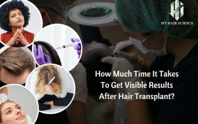 How much time it takes to get visible results after hair Transplants