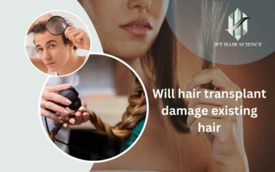 Will hair transplant damage existing hair