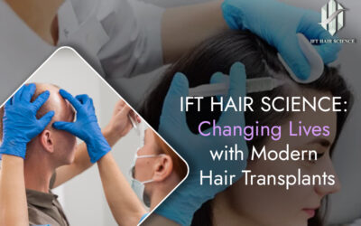 IFT Hair Science: Changing Lives with Modern Hair Transplants