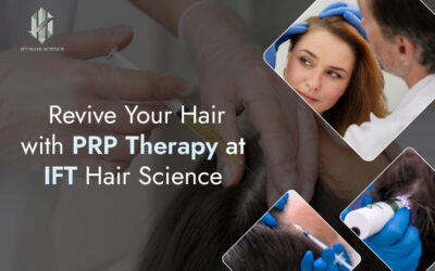 Revive Your Hair with PRP Therapy at IFT Hair Science