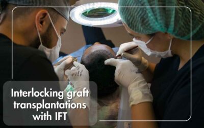 Unlocking the Secrets of Interlocking Graft Transplantation: Innovative Hair Loss Solutions at IFT Hair Science Clinic in Jaipur
