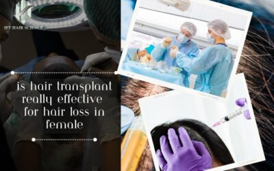Is Hair Transplant Really Effective For Hair Loss in Female