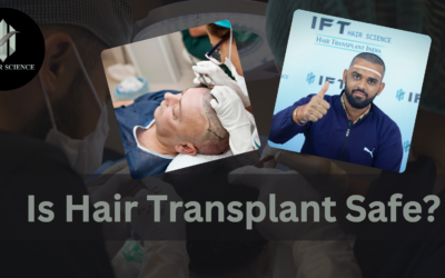 Is Hair Transplant Safe? Understanding the Procedure and Risks