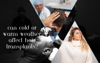Can cold or warm weather affect hair transplants