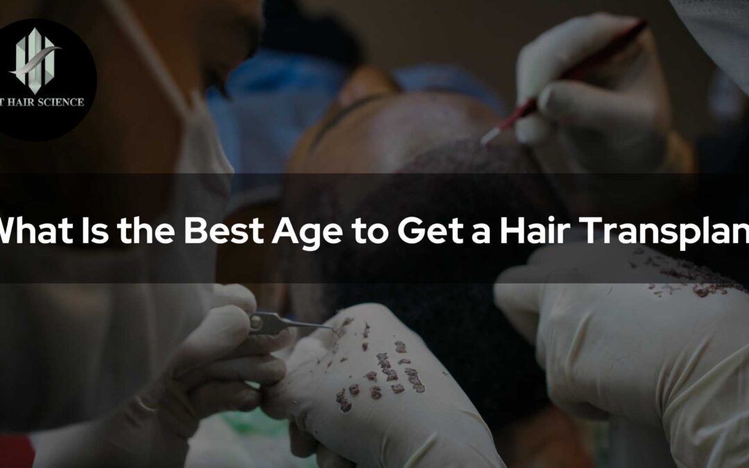 What Is the Best Age to Get a Hair Transplant?