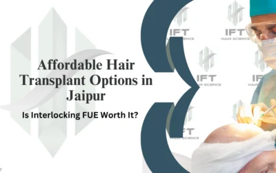 Affordable Hair Transplant Options in Jaipur: Is Interlocking FUE Worth It?