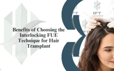 Benefits of Choosing the Interlocking FUE Technique for Hair Transplant