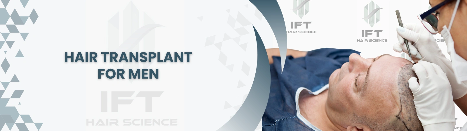 hair transplant for men