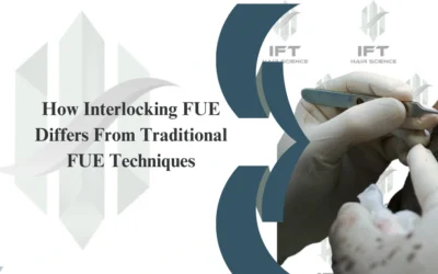 How Interlocking FUE Differs From Traditional FUE Techniques