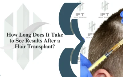 How Long Does It Take to See Results After a Hair Transplant?