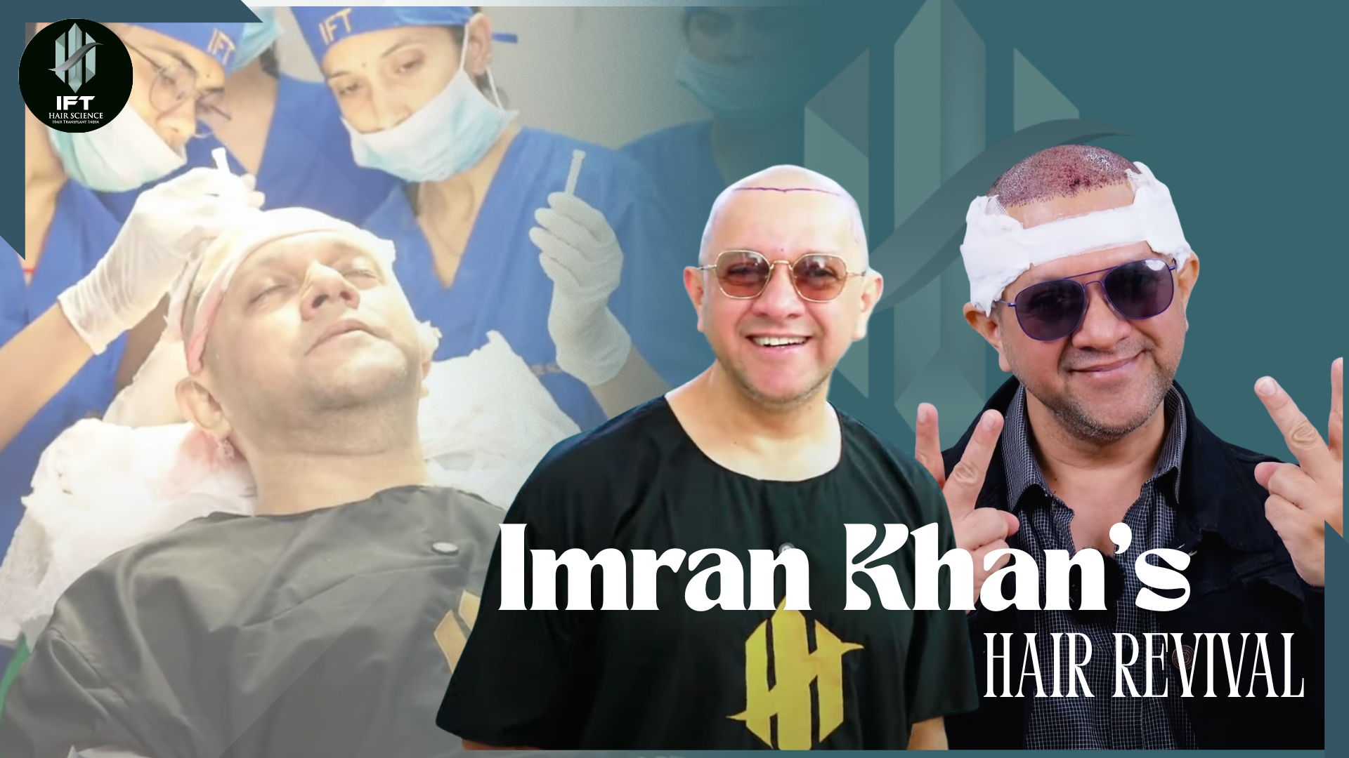 imran khan hair transplant in ift celebrity hair transplant