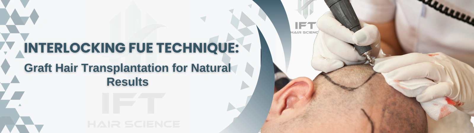 interlocking fue technique
