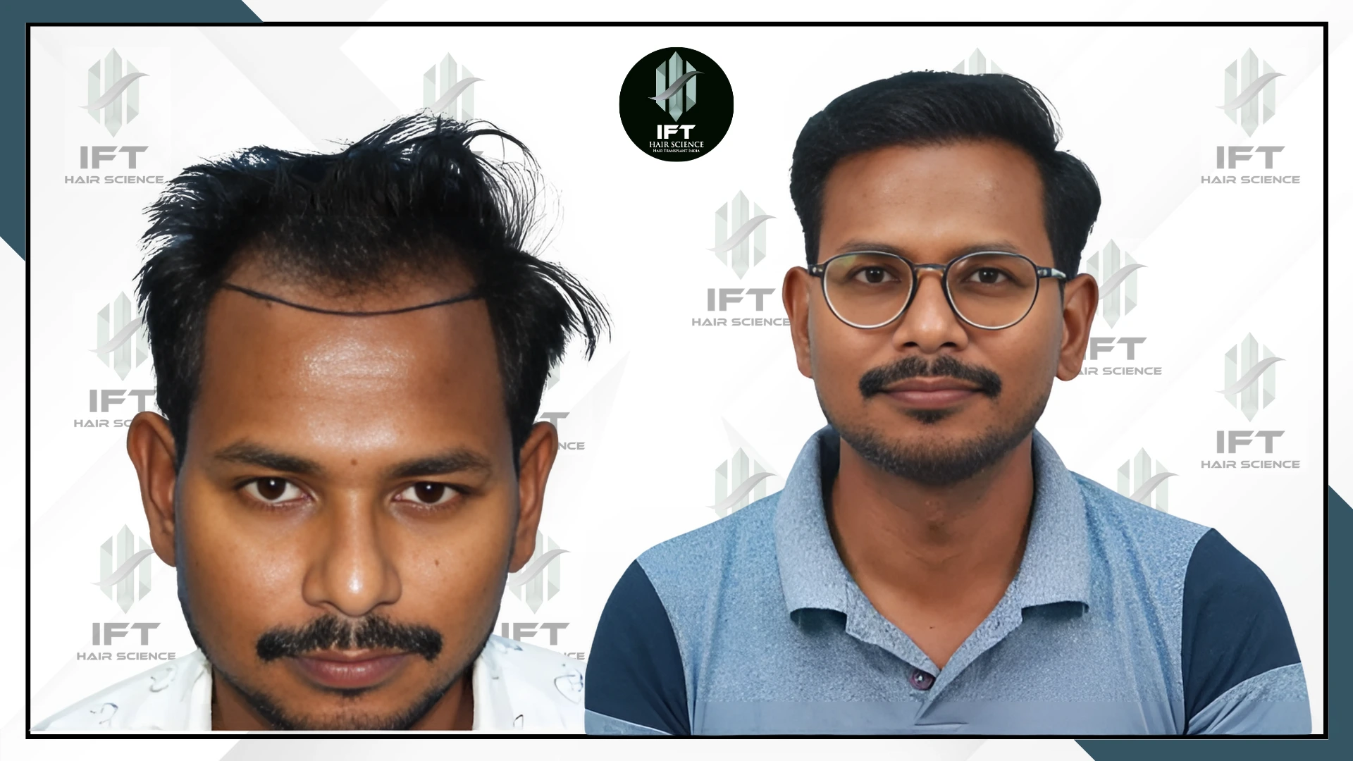 patientsnamerakeshpali rakesh_pali (1)