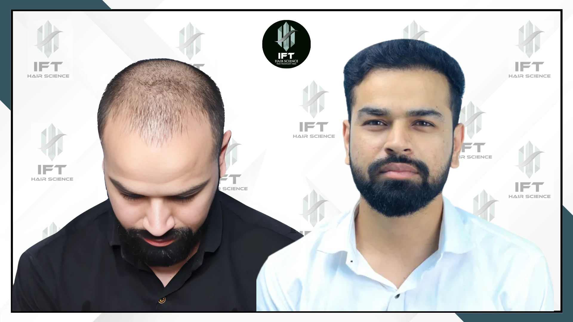 patients name abhishek patidar tonk web_ba_4