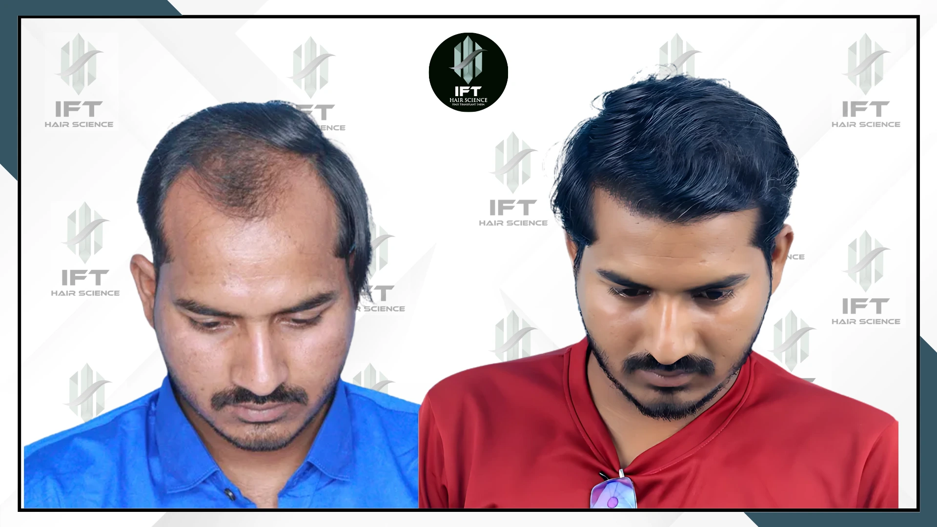 patients name chotu ram jaipur web_ba_1