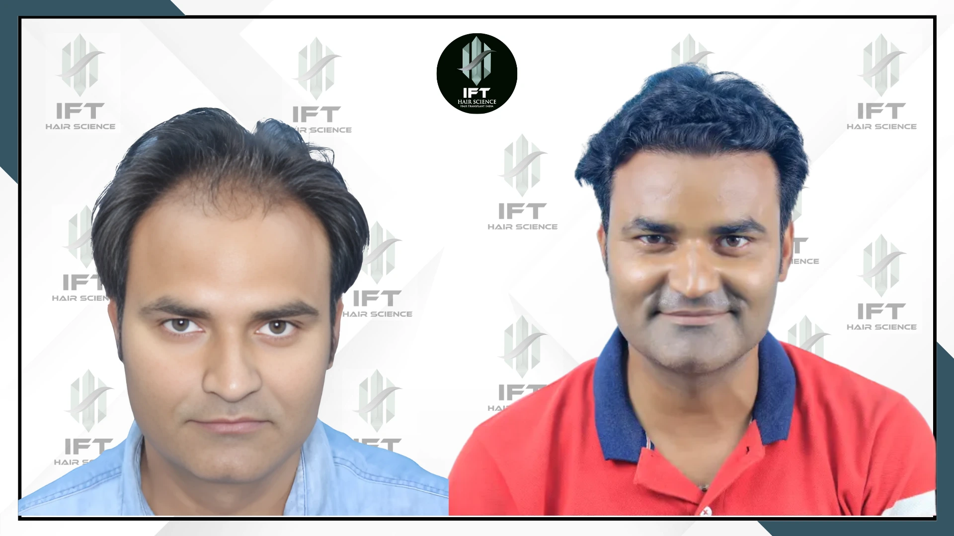 patients name dhiraj- bharatpur web_ba_3