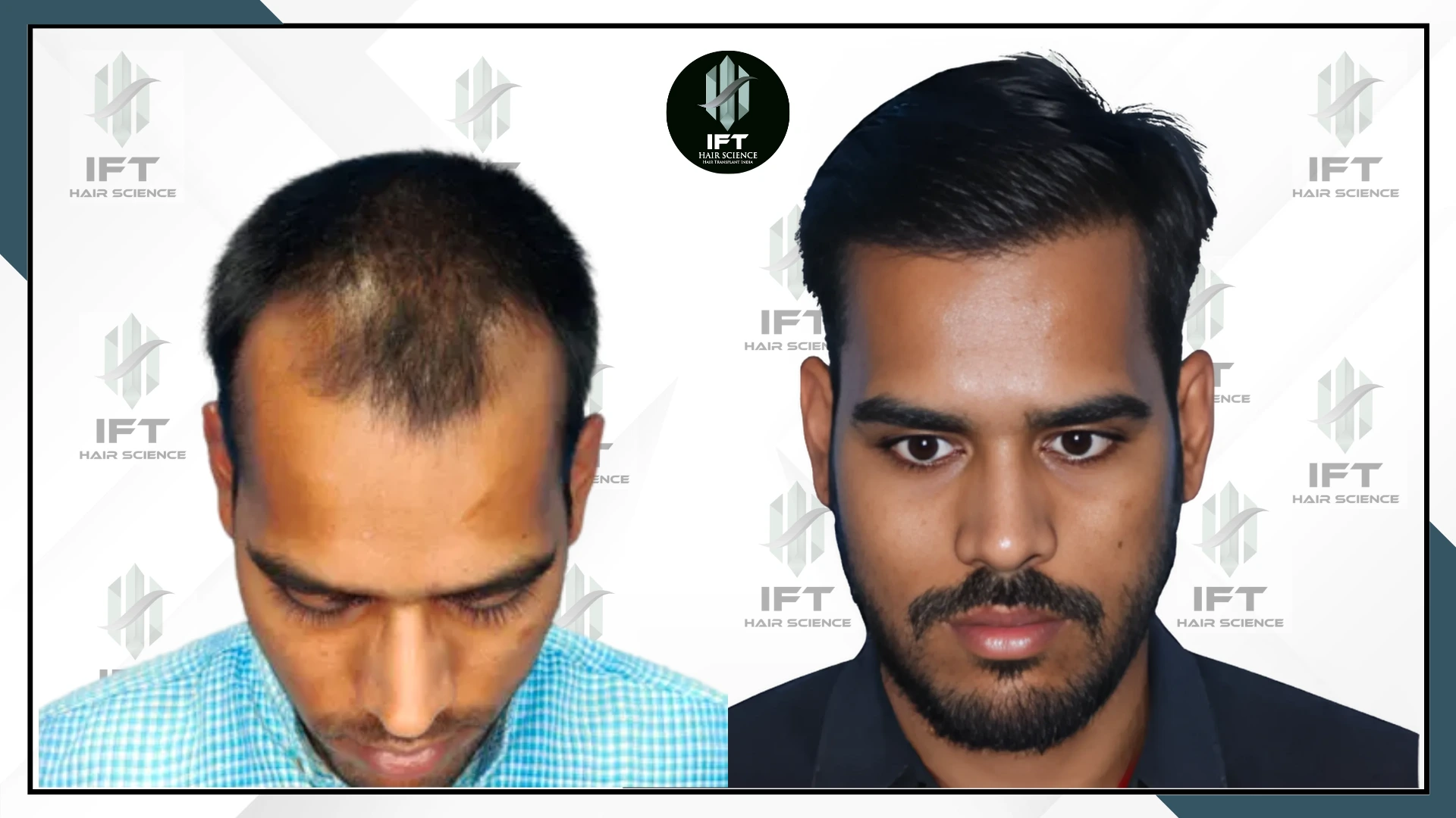 patients name gaurav ajmer web_ba_4