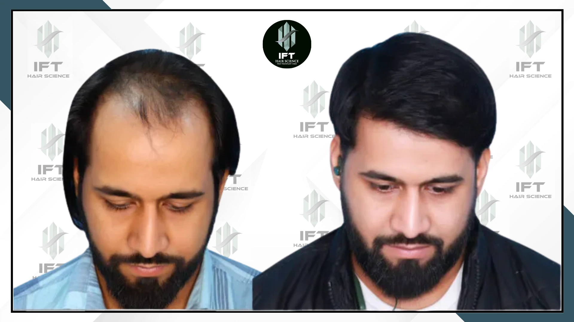 patients name haider abbas jaipur web_ba_3