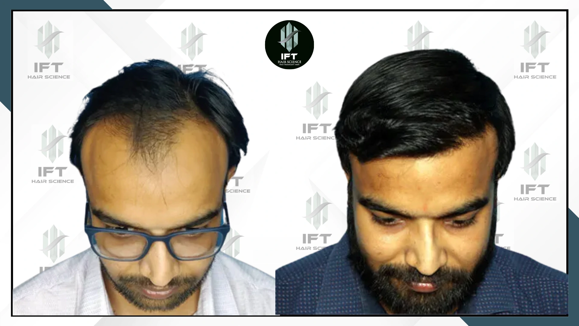 patients name nihal gupta jodhpur web_ba_4