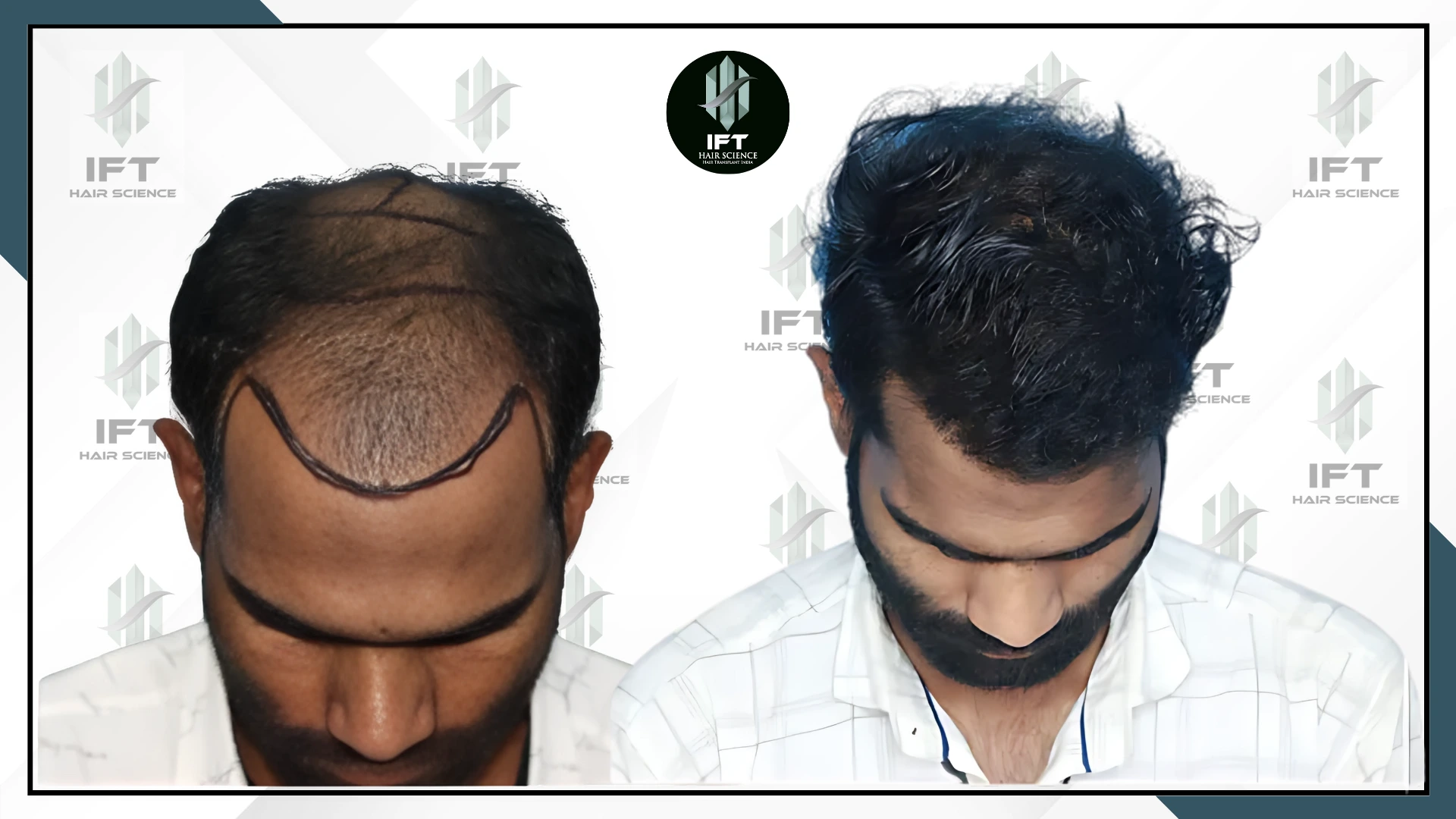 patients name ranjit bhilwara ranjit_-_bhilwara