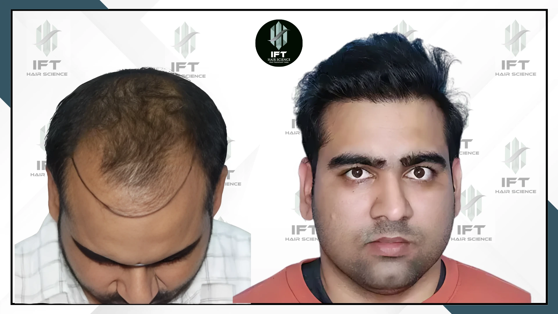 patients name sovind delhi sovind-delhi