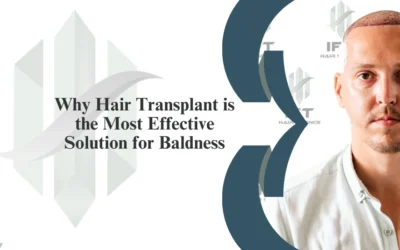 Why Hair Transplant is the Most Effective Solution for Baldness