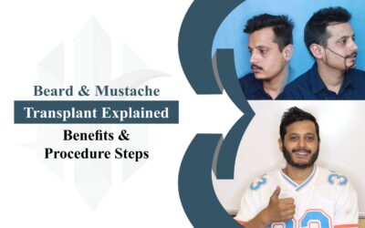 Beard & Mustache Transplant Explained: Benefits and Procedure Steps